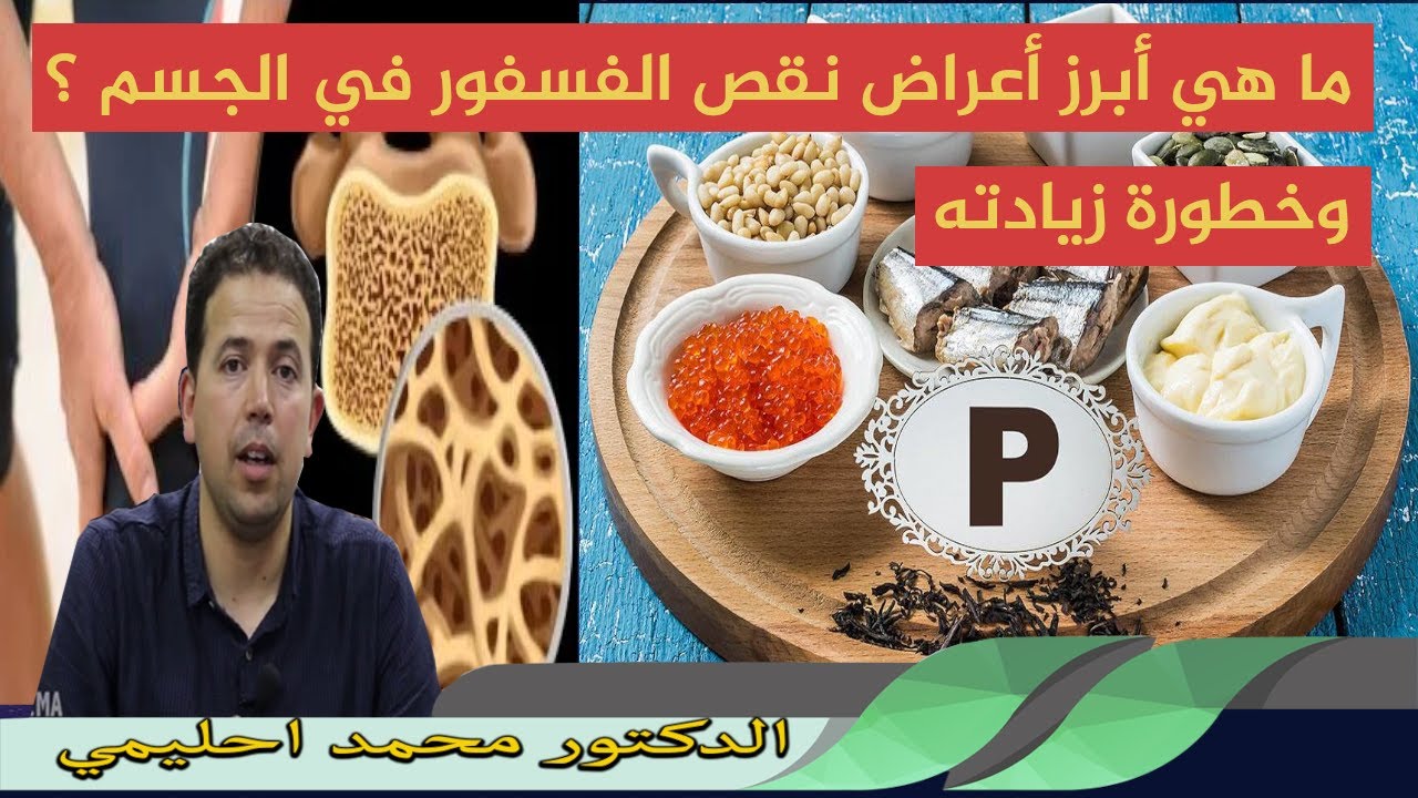 ما هي أبرز أعراض نقص الفسفور وأعراض زيادته في الجسم ؟ الدكتور محمد احليمي