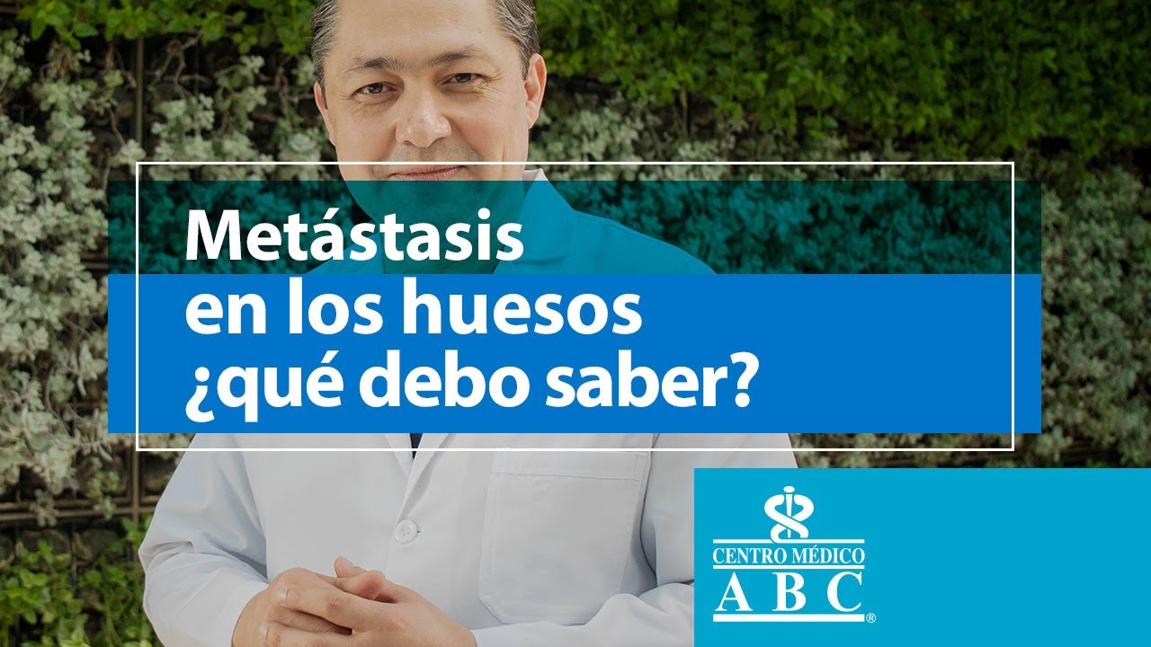 Metástasis en los huesos, ¿qué debo saber?