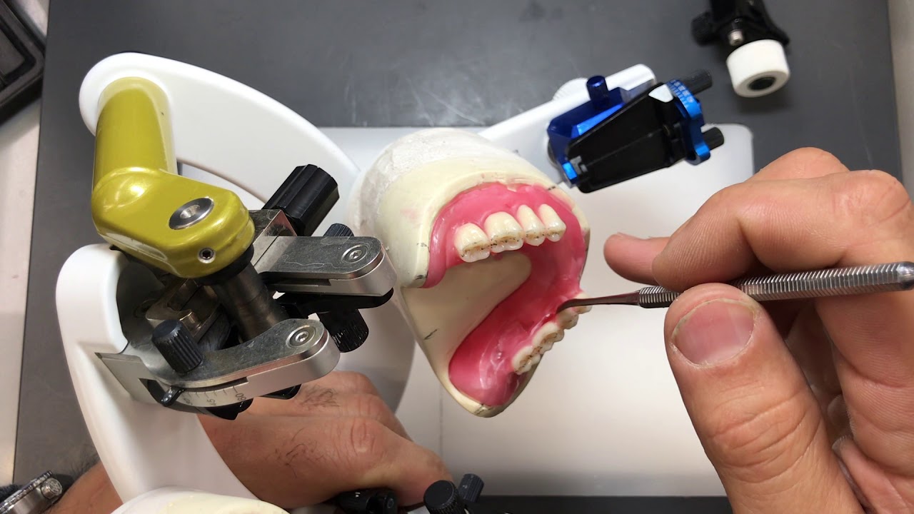 Complete Maxillary and Mandibular Tooth Arrangement #6