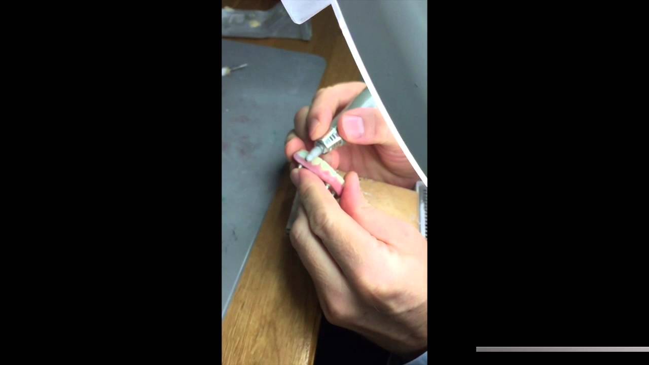 BDT Implant Bridge bond strength test