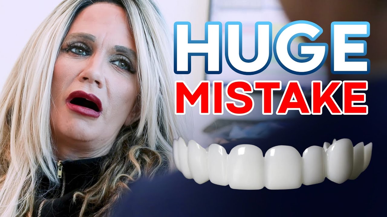 I Regret Getting Snap-On Veneers | Can It Be Fixed?