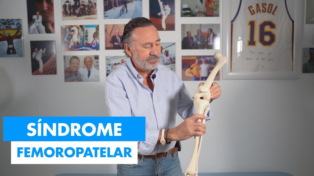 Síndrome Femoropatelar - causas y tratamiento