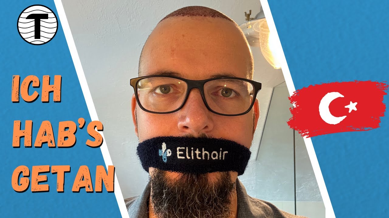 Ich hab’s getan – Haartransplantation Türkei 🇹🇷 #TomTuT #ReiseVlog #erfahrungsbericht
