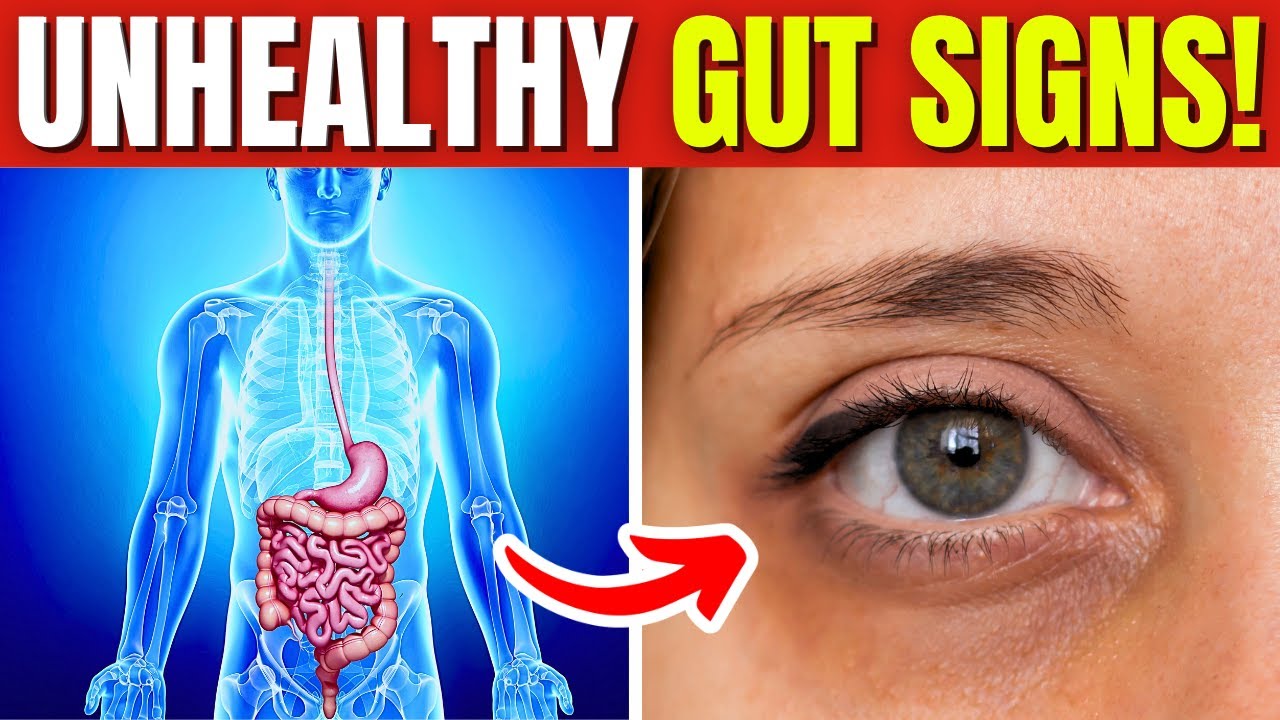 10 Warning Signs You Have an Unhealthy Gut