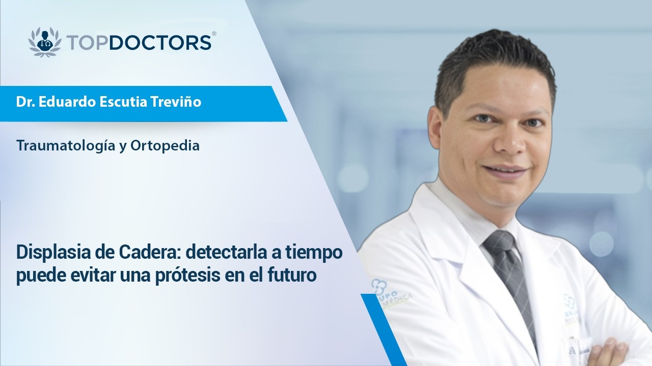 Displasia de cadera: detectarla a tiempo puede evitar una prótesis en el futuro