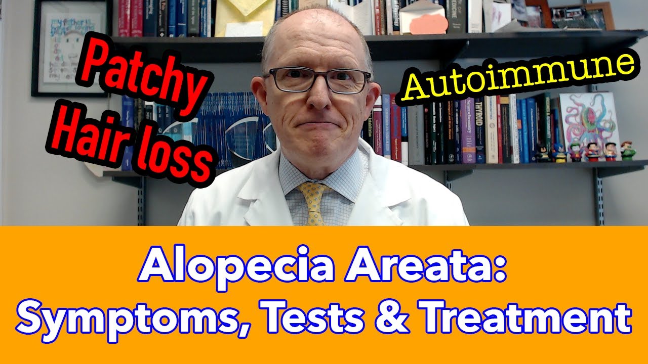Alopecia Areata Autoimmune Hair Loss - Symptoms, Tests, Treatment
