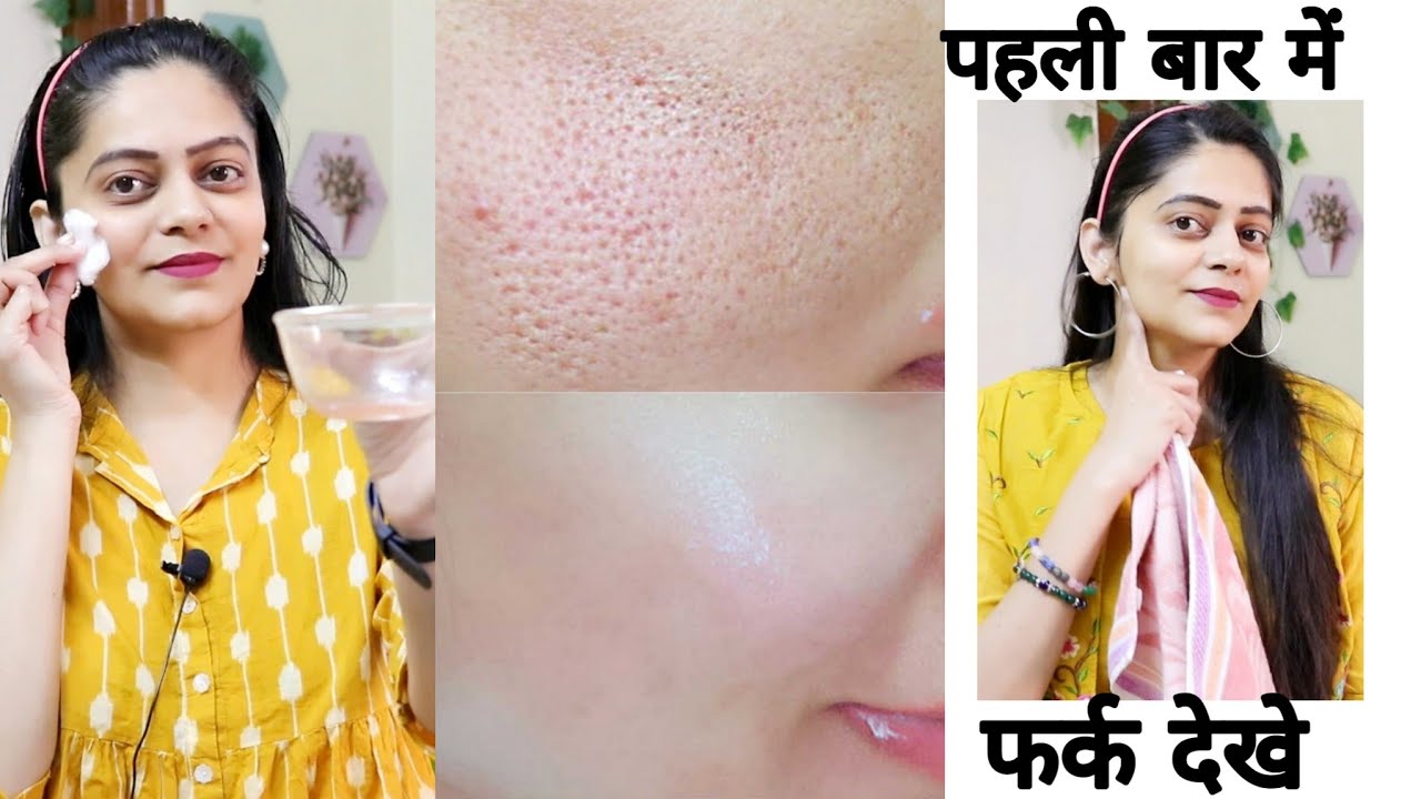 सिर्फ इसकी 2 बूंद चेहरे पे लगाएं गारंटी स्किन टाइट खूबसूरत झुर्रिया झाइयां जड़ से ख़त्म होगी