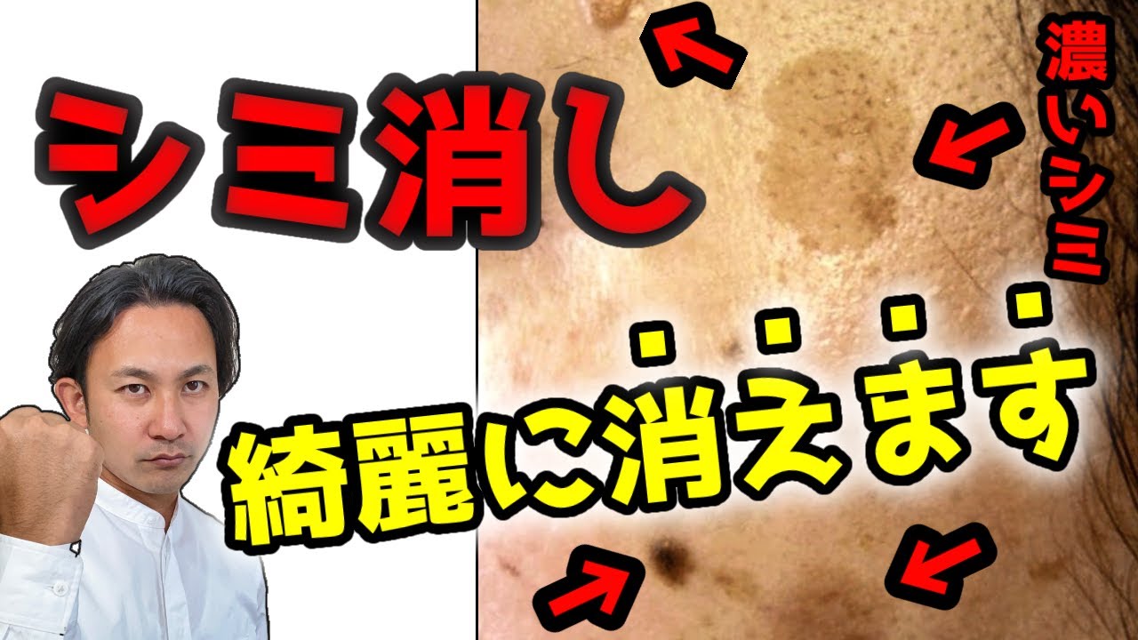 濃いシミも消す一番の方法はこれ！昔の美肌が蘇る。【化粧品原料のプロが解説】