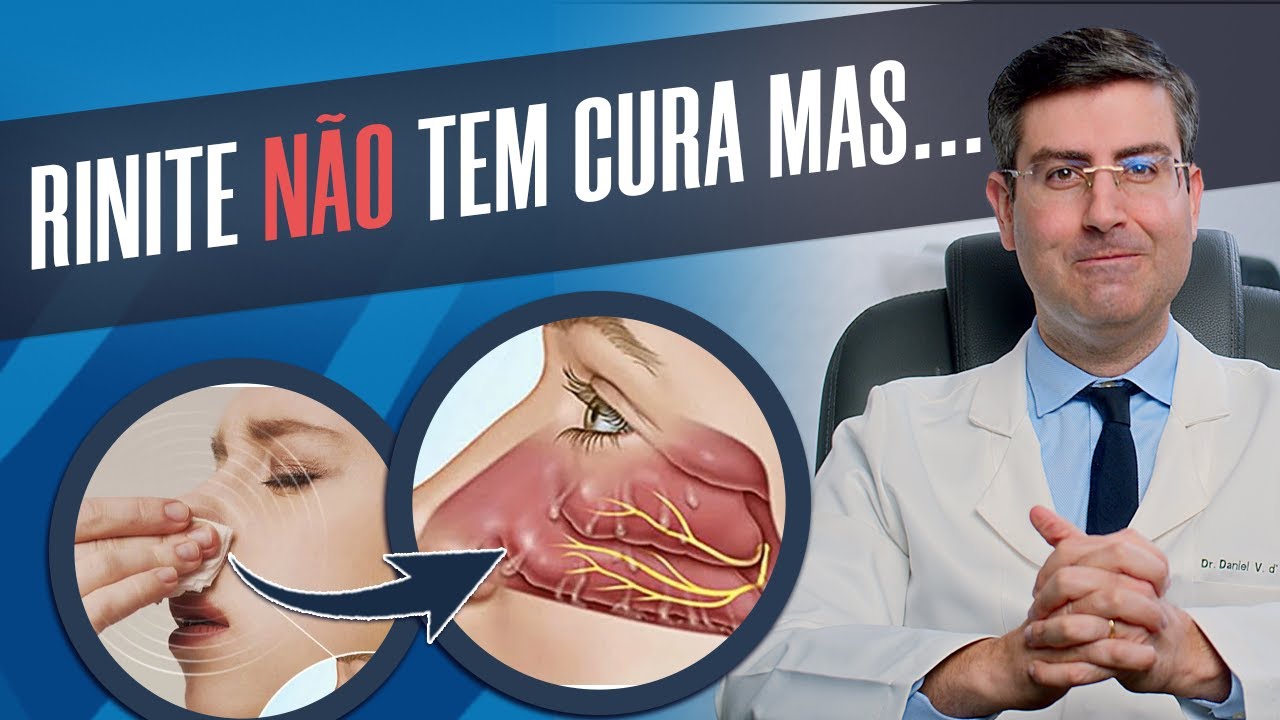 RINITE tem CURA? M&eacute;dico Otorrino responde