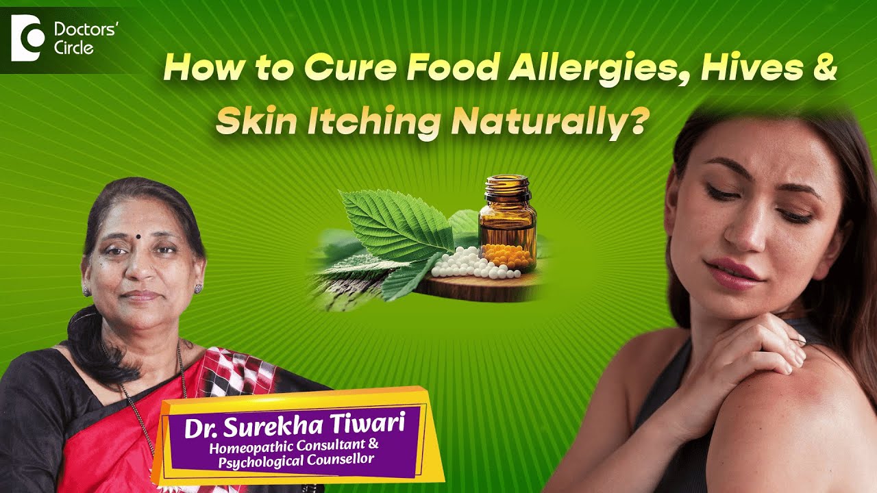 Hives Allergy Treatment At Home | Best Homeopathic Medicines  - Dr. Surekha Tiwari | Doctors' Circle
