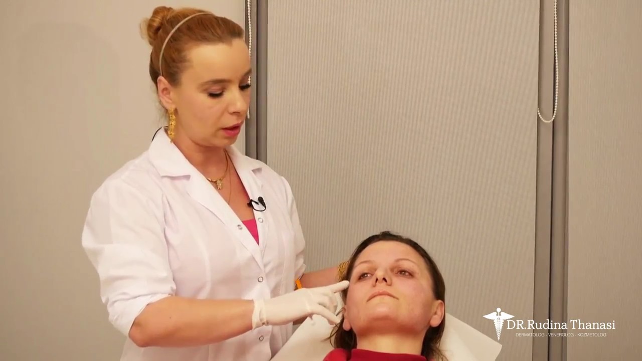 Cfarë duhet të evitojmë gjatë injektimit me Botox