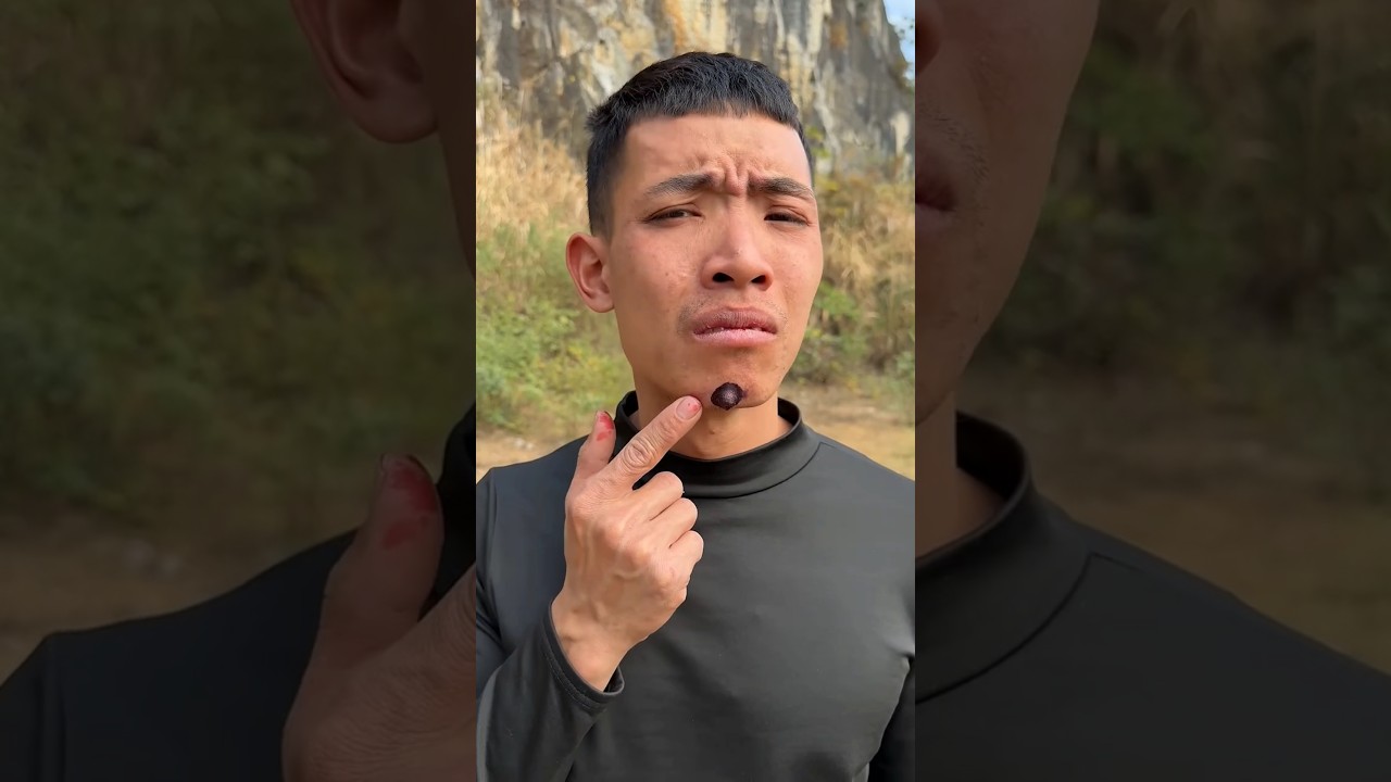 How I Cured a Bug Bite with Yogurt #short #949