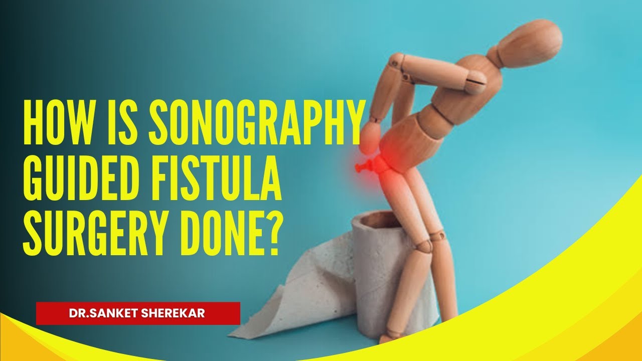 Sonography-Guided Fistula Surgery: Procedure, Benefits, and Recovery Explained