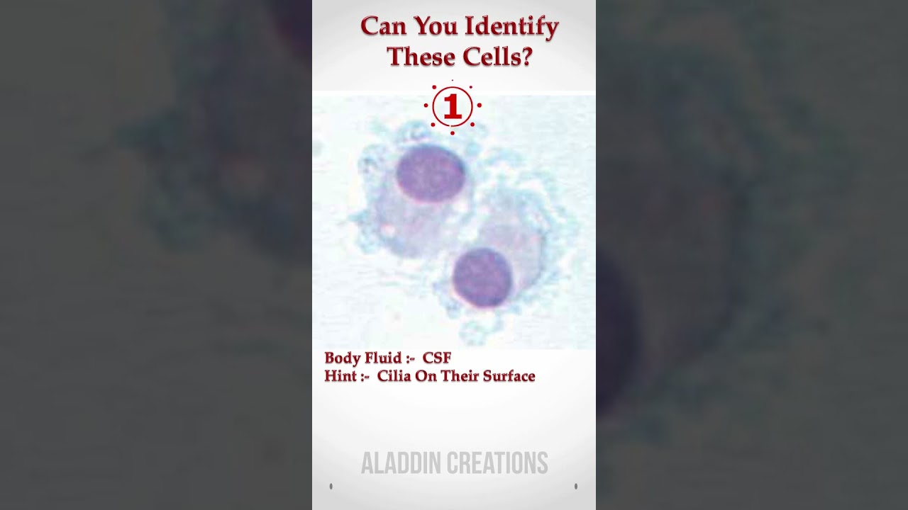 Can you identify these Cells In Body Fluid ? 🧐🙄🤔 