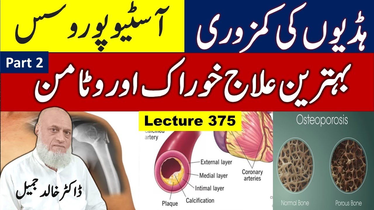 Weak bones and Osteoporosis , Best treatment with Diet and Vitamins | lecture  375 , Part 2