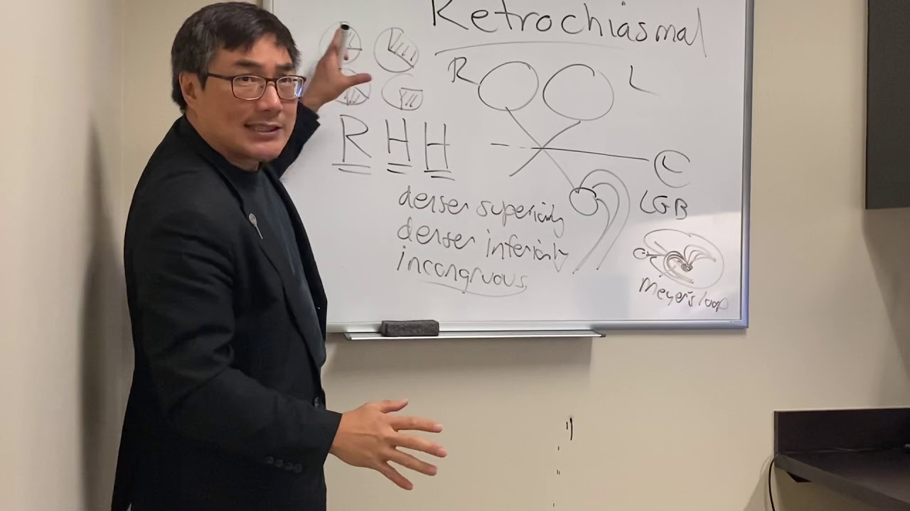 Retrochiasmal pathway