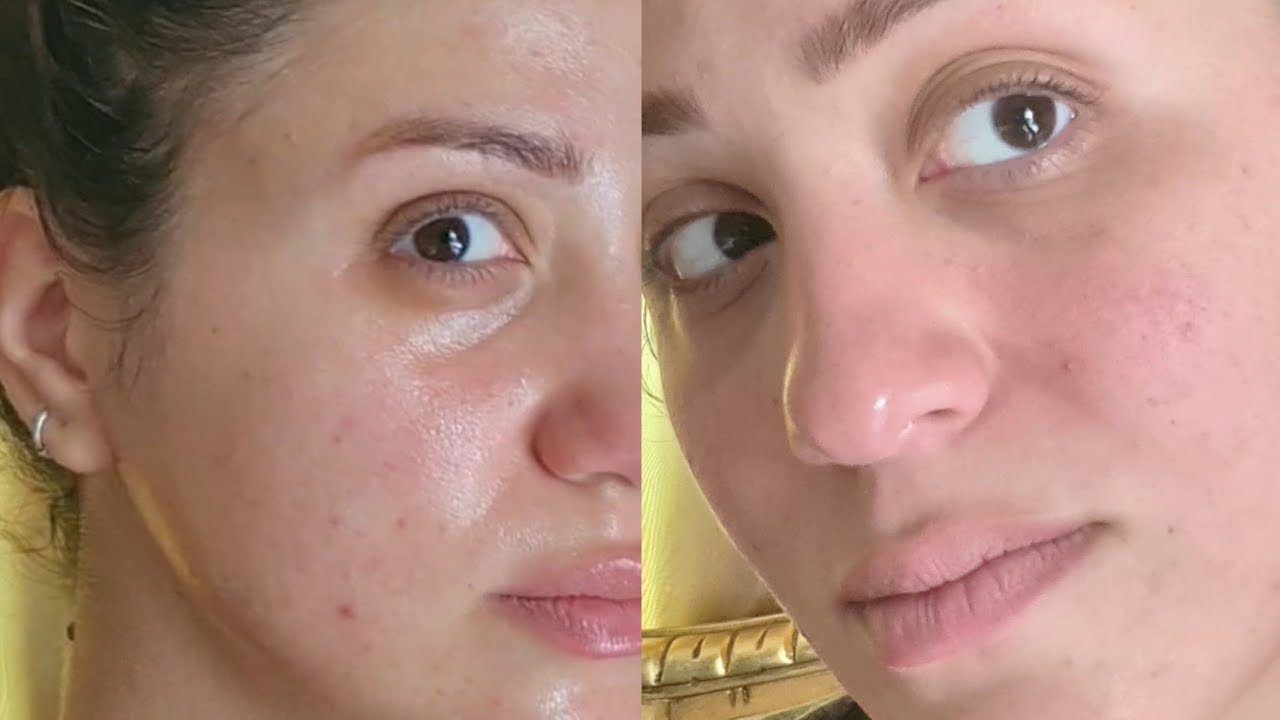 تجربه تنظيف الوجه بالزيت لمده 15 دقيقه  oil cleansing