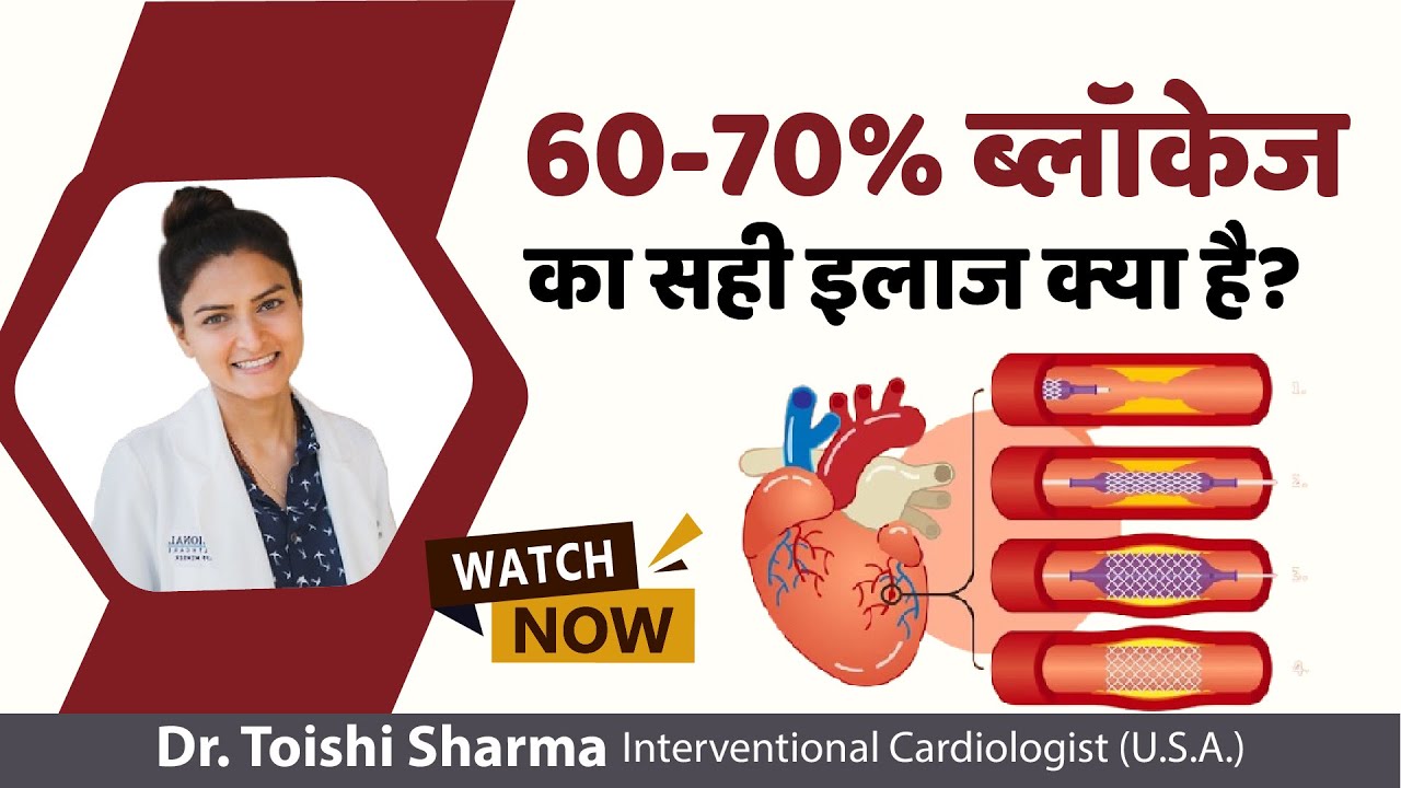 60 - 70% ब्लॉकेज का सही इलाज क्या है? Heart Blockage Treatment In Delhi, India - Dr Toishi Sharma