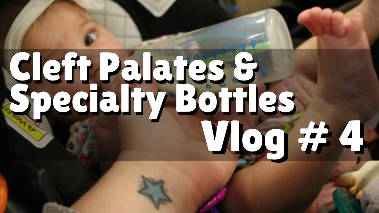 Cleft Palates & Specialty Bottles