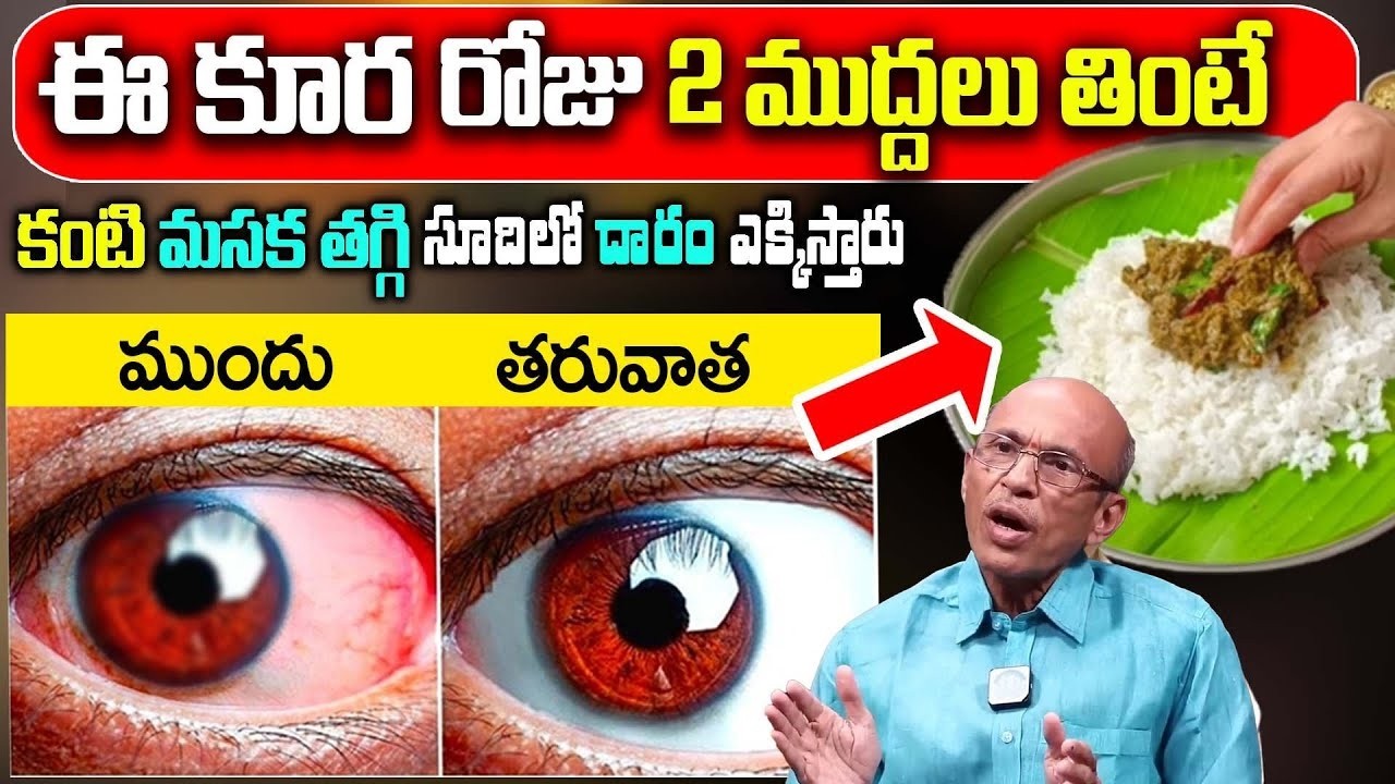 కంటి చూపు మెరుగుపరిచే అద్భుతమైన చిట్కా | Eye Health Tips in Telugu | iDream Doctors