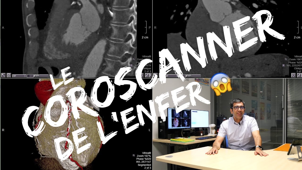 Un coroscanner TRES difficile - cas clinique didactique