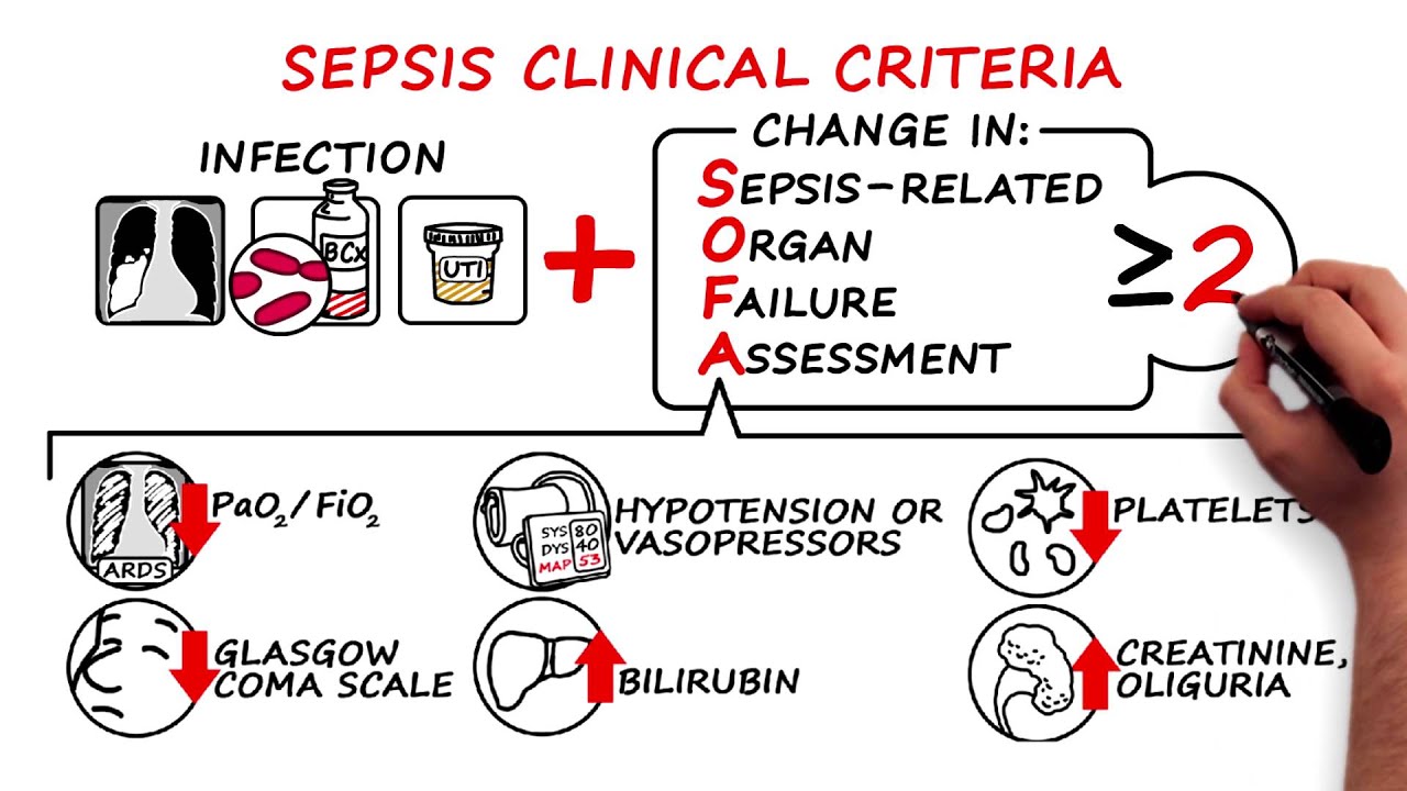 Sepsis and Septic Shock - 2016 Consensus Definitions