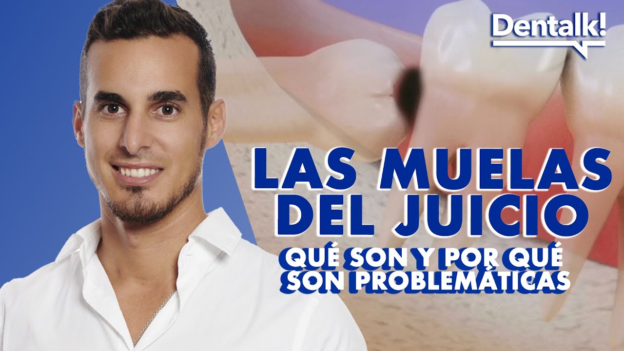 ¿Te DUELEN las MUELAS DEL JUICIO? - Todo sobre el DOLOR en los cordales y su EXTRACCIÓN | Dentalk! ©