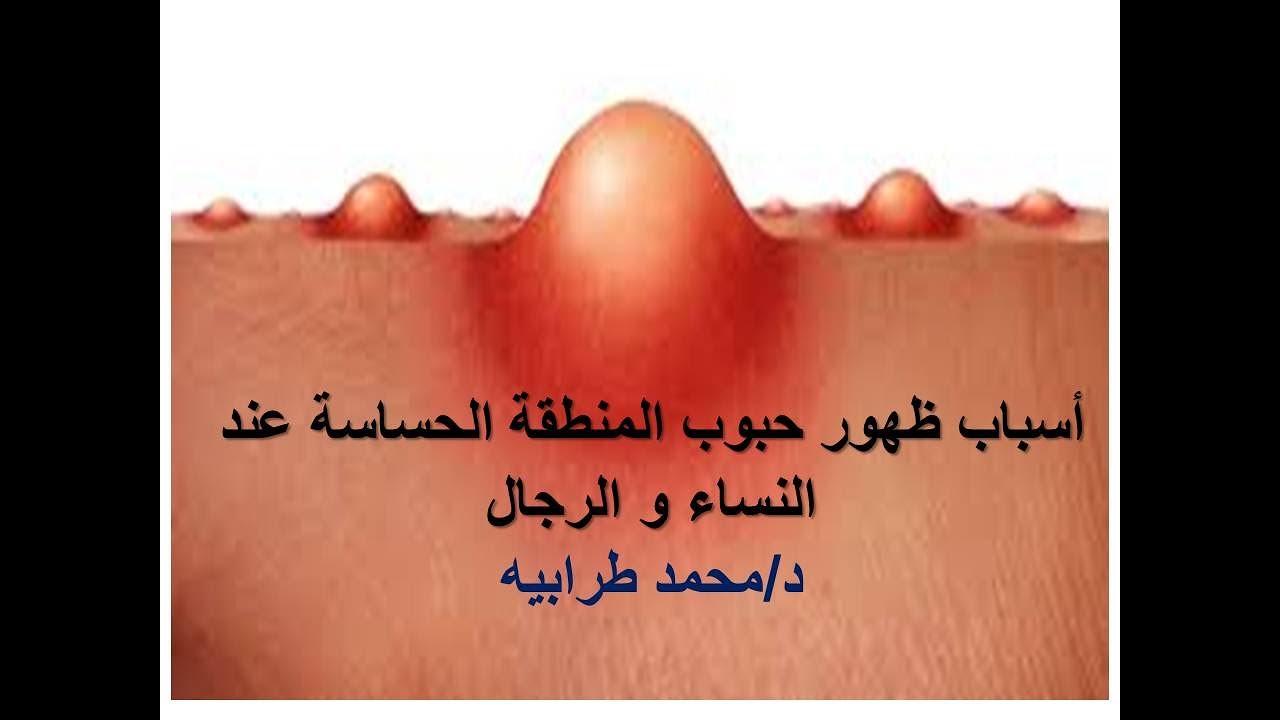أسباب ظهور حبوب المنطقة الحساسة عند النساء و الرجال . #دكتور_محمد_طرابيه