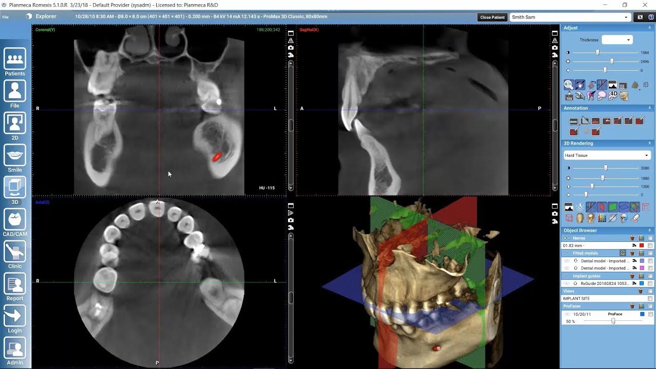 Examining 3D images in Planmeca Romexis