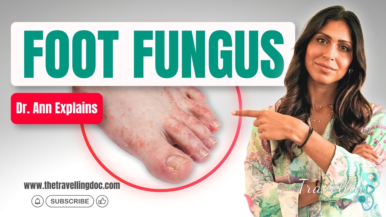 The Most Common Mistakes People Make When Treating Athlete's Foot. Infection.