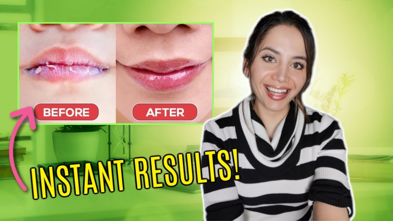 How To STOP Peeling Lips FAST (NOT VASELINE)  | 3 EASY Steps