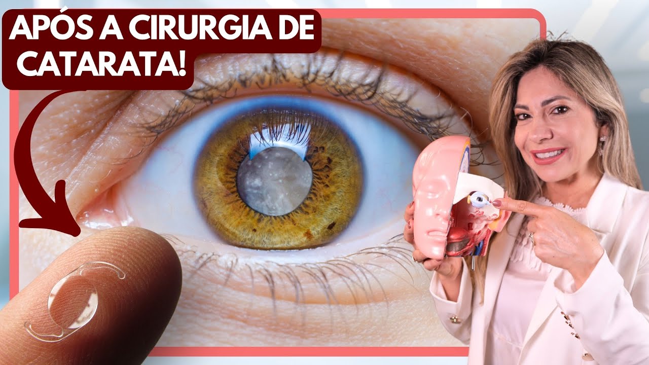 Cirurgia de Catarata Com Lentes Multifocais: Veja o Mundo Sem &Oacute;culos!
