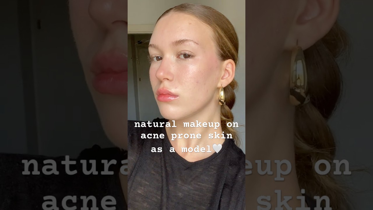 natural makeup as a model with acne prone skin