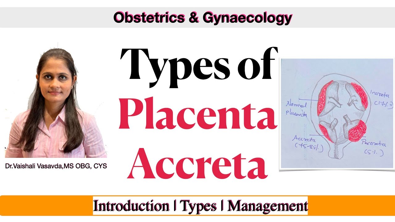 Placenta Accreta — Types, Management Explained | Dr. Vaishali | Gynaecology by Dr Vaishali