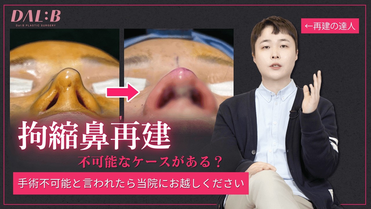 【VOL.2】拘縮で変形した鼻、治せますか？再手術の限界と可能性を専門医が解説｜韓国・シンサ駅 ダルビ美容外科