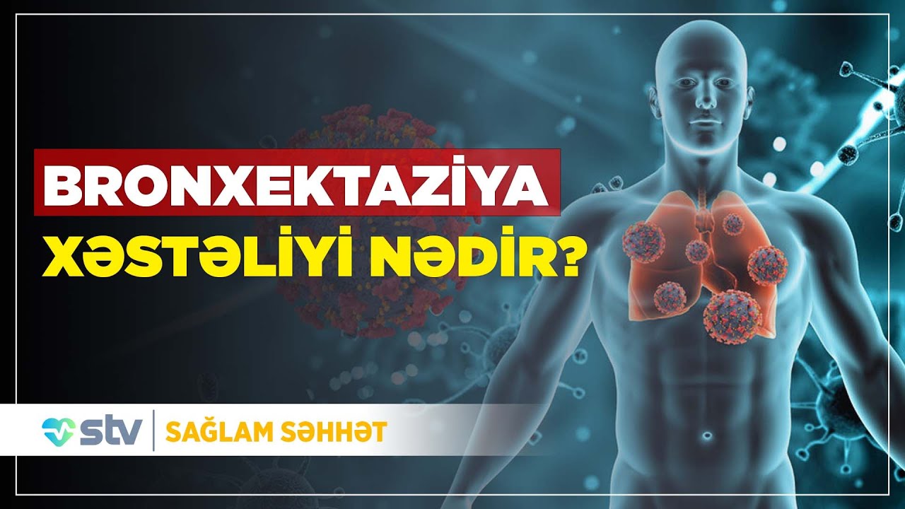 BRONXEKTAZİYA XƏSTƏLİYİ NƏDİR? - SAĞLAM SƏHHƏT (22.11.2024)