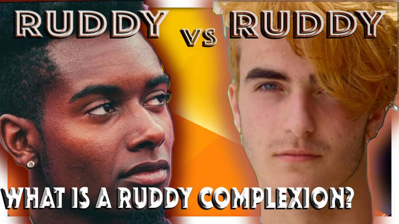 What is a Ruddy Complexion?  (2021)