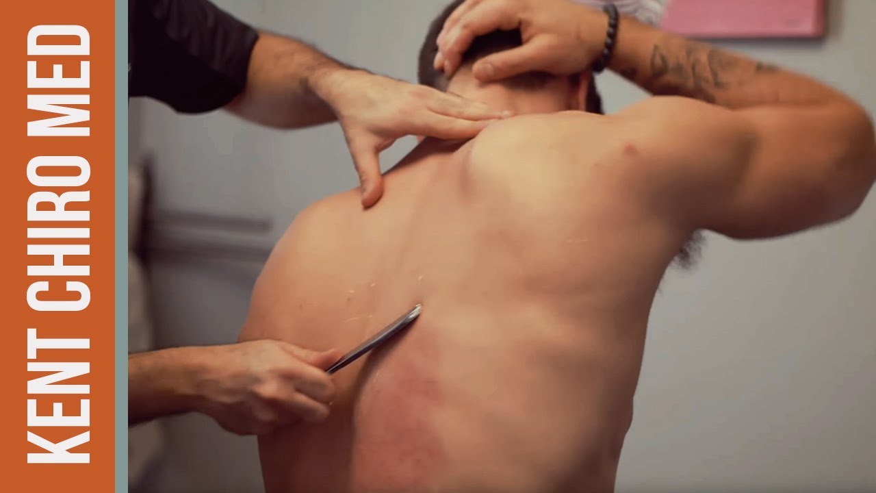 26 year old Barber with Midback pain. See his IMMEDIATE relief with chiropractic care!
