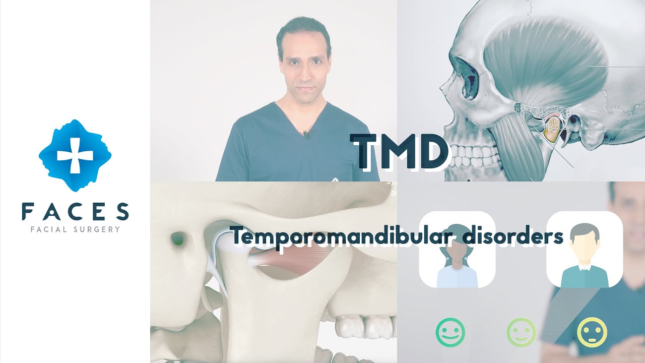 Temporomandibular joint disorders - Miguel L. Oliveira