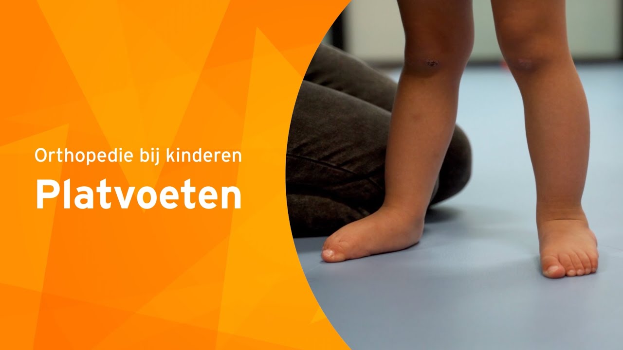 Orthopedie bij kinderen - Platvoeten