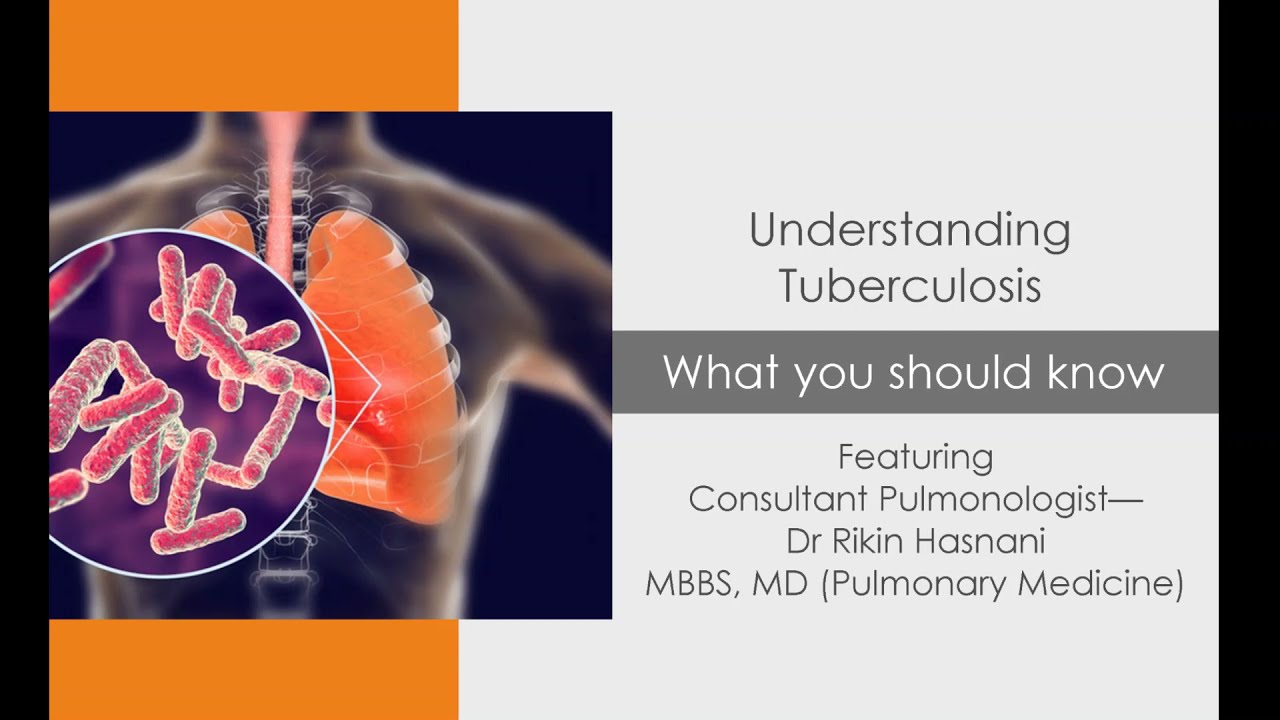 Understanding Tuberculosis - What you should know