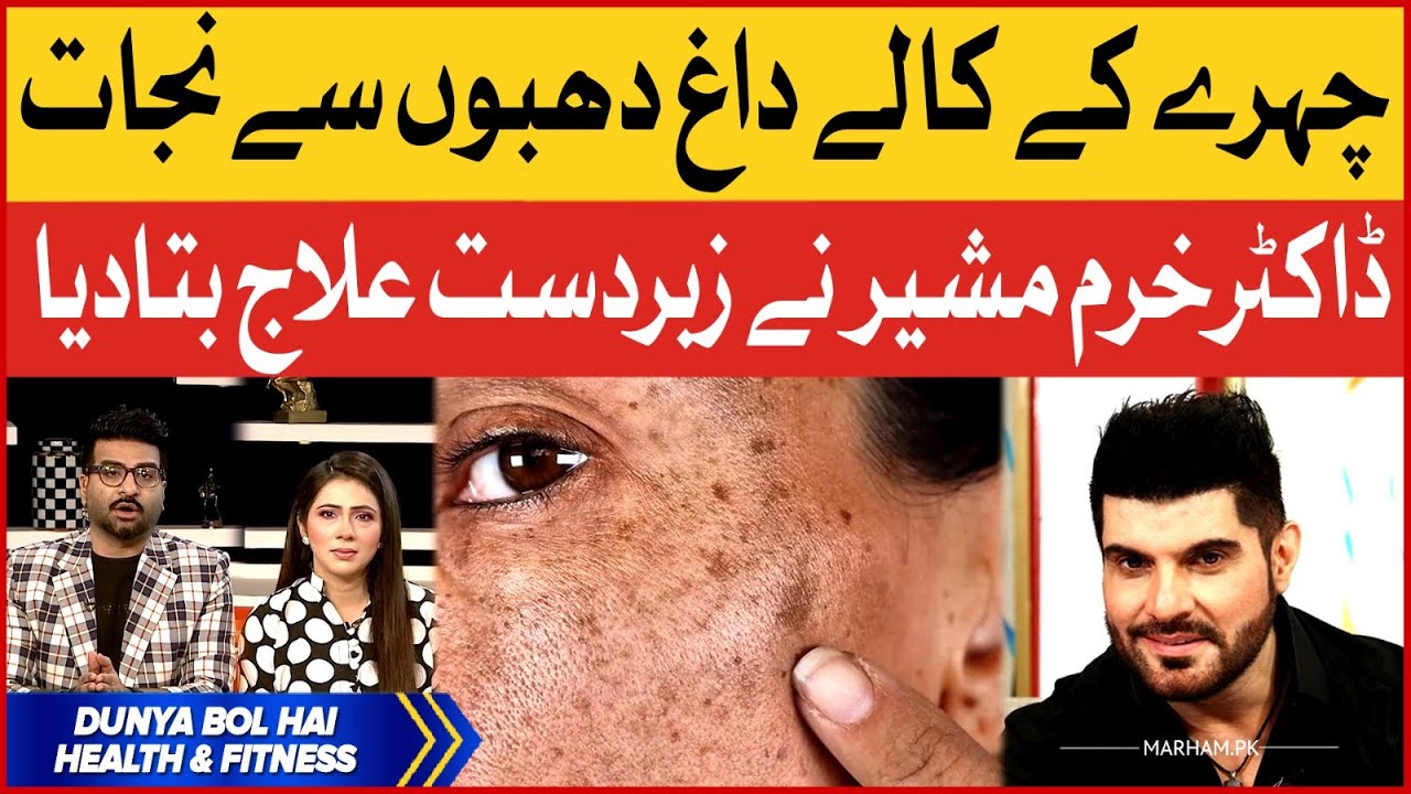 Treatment Of Dark Spots on Face | Dr Khurram Mushir Special Tips | BOL News
