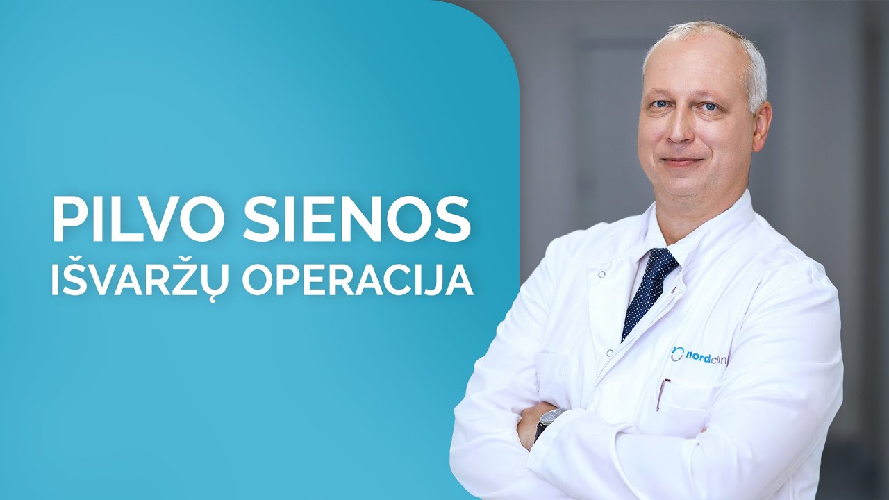 Pilvo sienos i&scaron;varžų operacija | Gydytojas Linas Venclauskas