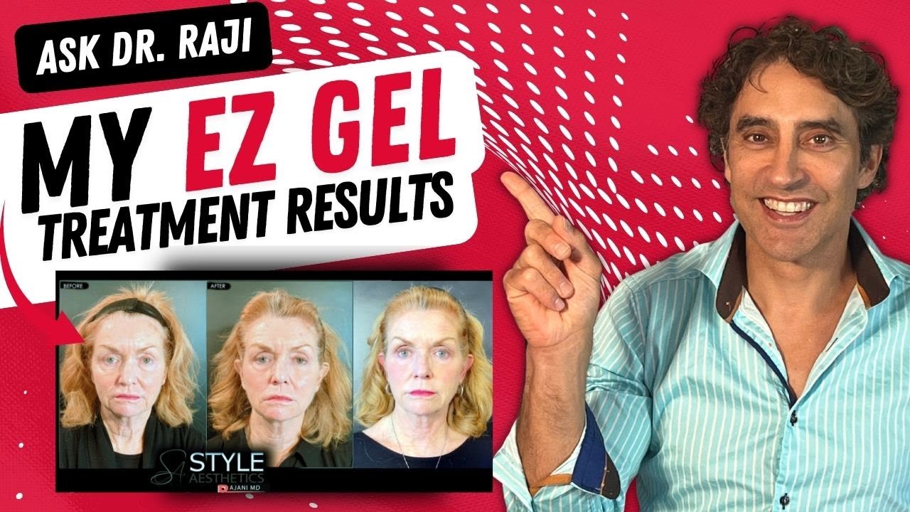 РЕЗУЛЬТАТЫ ПРИМЕНЕНИЯ MY All Natural EZ GEL ДЛЯ УХОДА ЗА ГЛАЗАМИ // Мешки под глазами