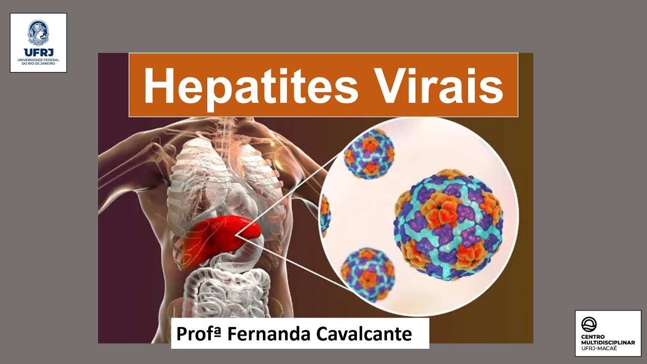 Aula Hepatites Virais - UFRJ Macaé