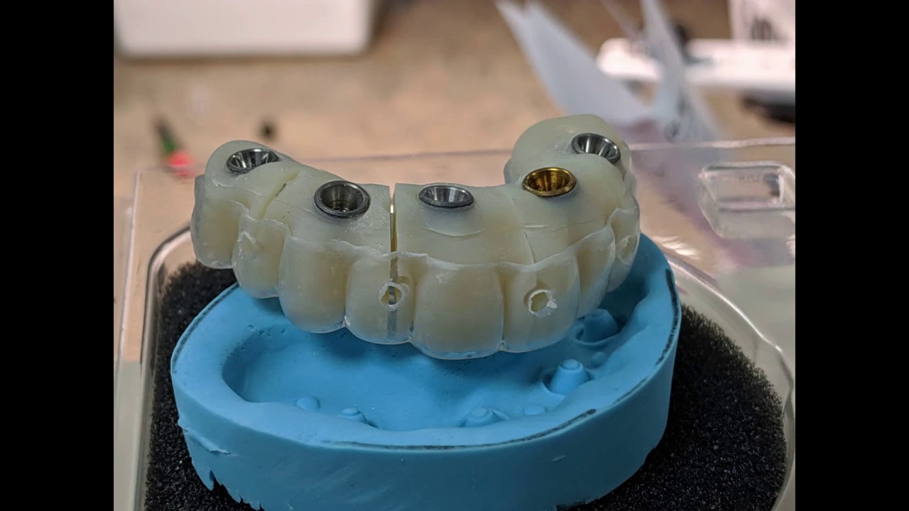 iJIG | Otella Dental