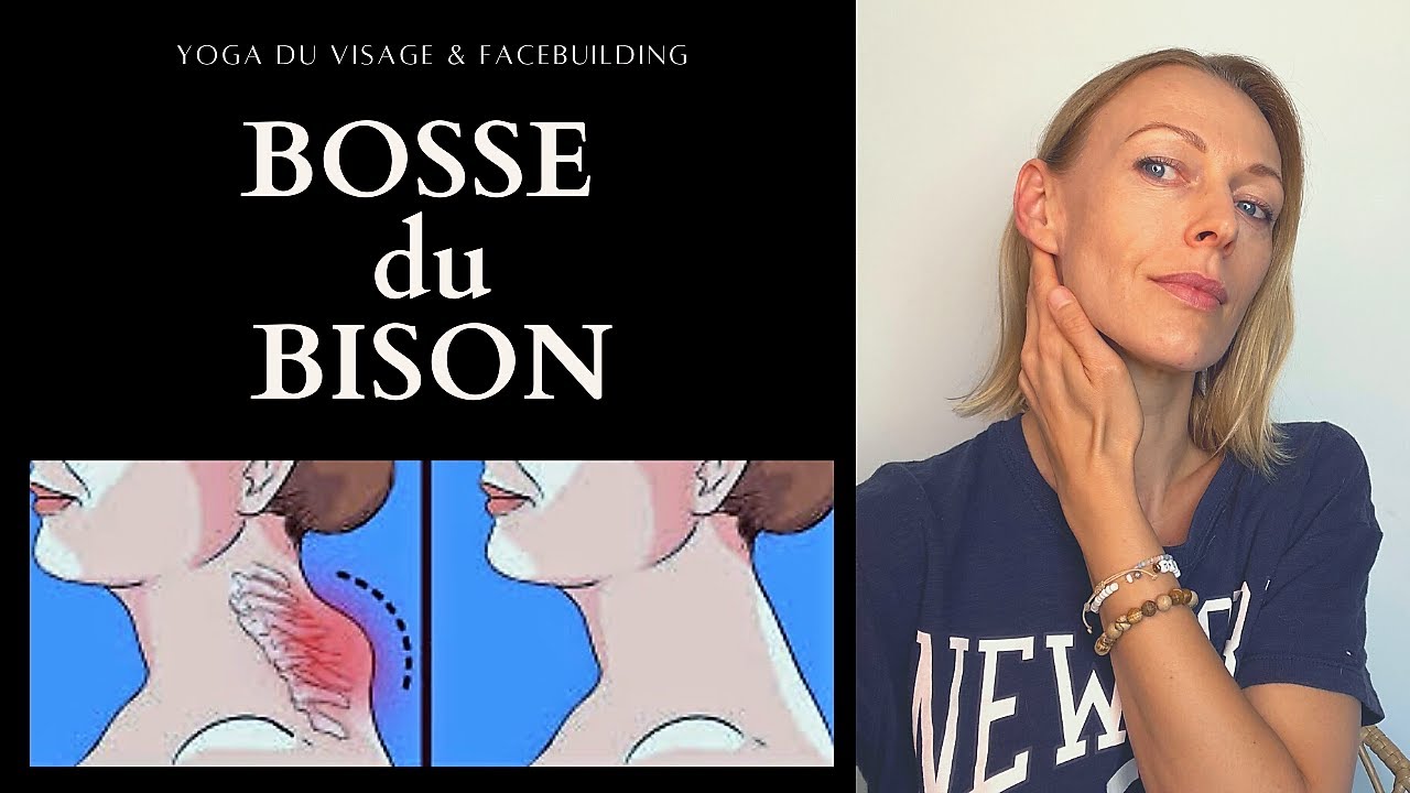 Bosse du bison, comment enlever et prévenir | Yoga du Visage | Facebuilding