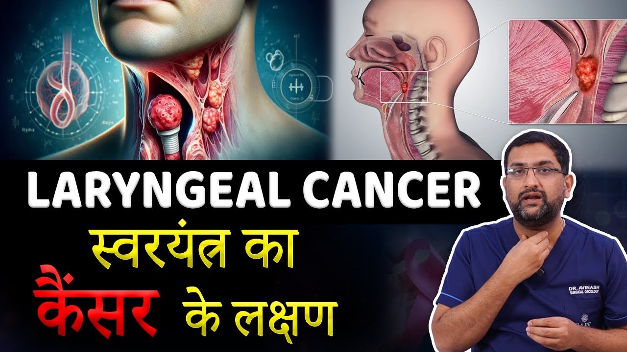 Throat cancer | स्वरयंत्र कैंसर के क्या लक्षण हैं? | Laryngeal cancer symptoms | Dr.Avinash | kaizen