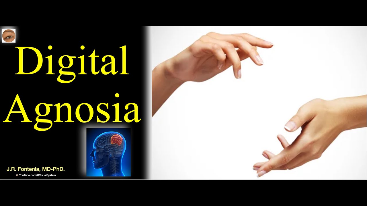 Agnosia Digital. Percepción Visual.