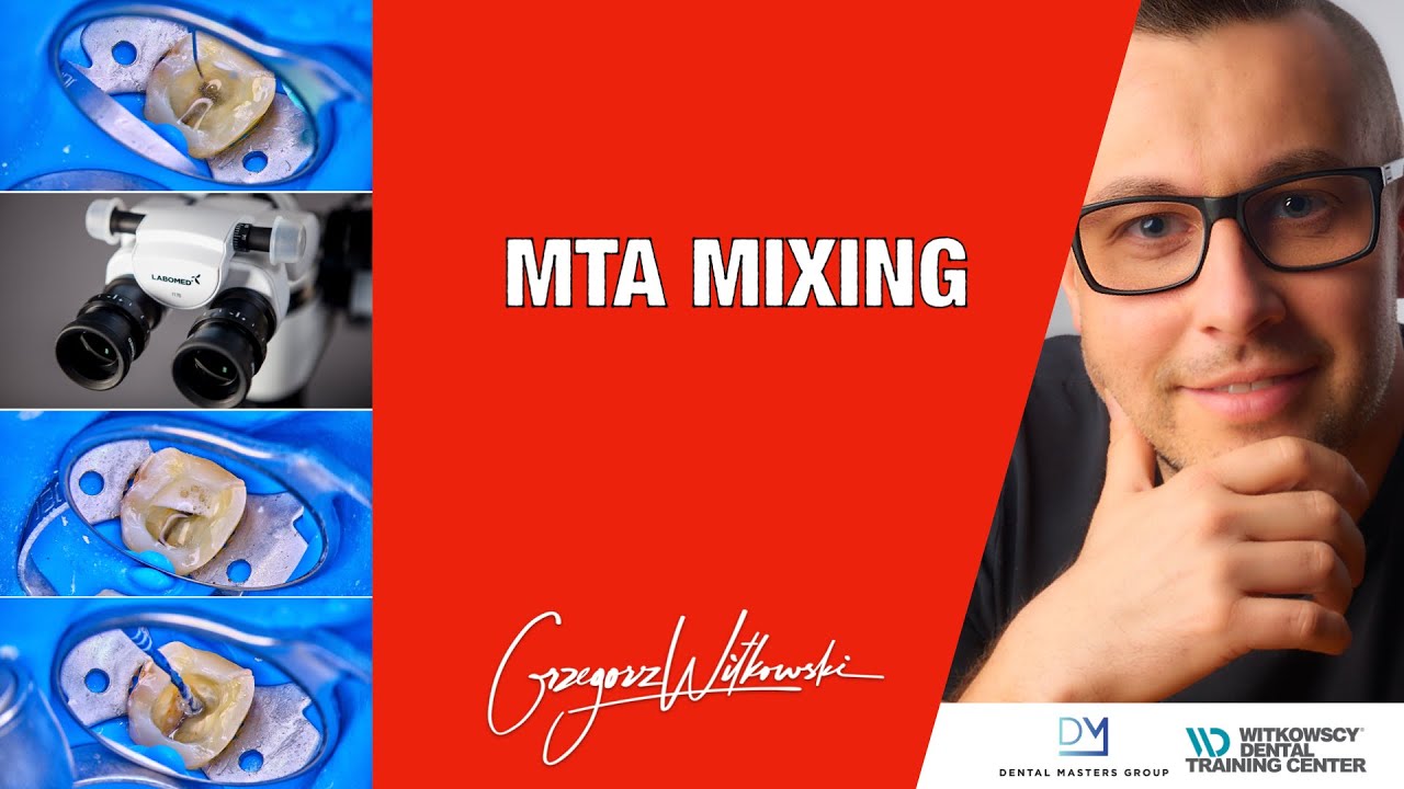 Mixing MTA